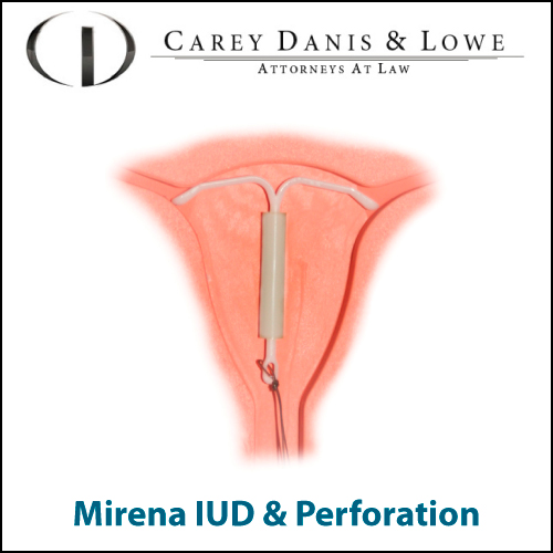 mirena diagram mirena iud side effects images mirena diagram mirena iud side effects images